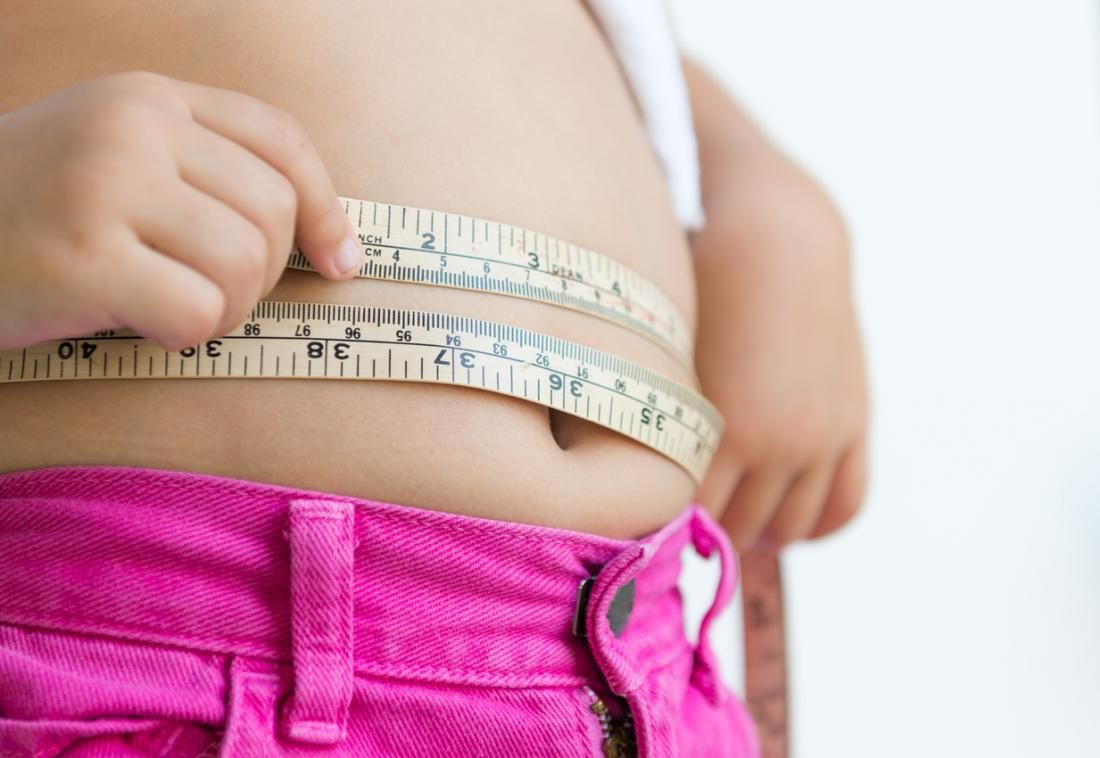 Cara Mudah Deteksi Obesitas Pada Si Kecil