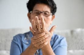 Seorang wanita mengalami gejala psoriasis arthritis.
