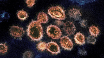 Kenali Varian Delta, Mutasi Virus Corona Baru yang Lebih Menular