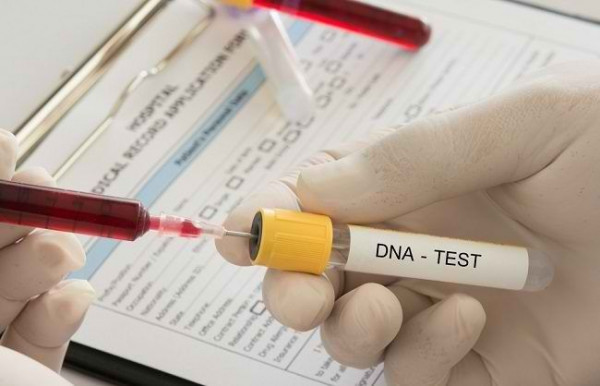 ilustrasi tes dna