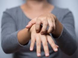 Seorang wanita sedang menggaruk tangan.