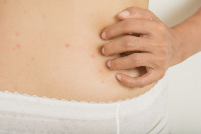 Bisakah Wanita Alergi Sperma?