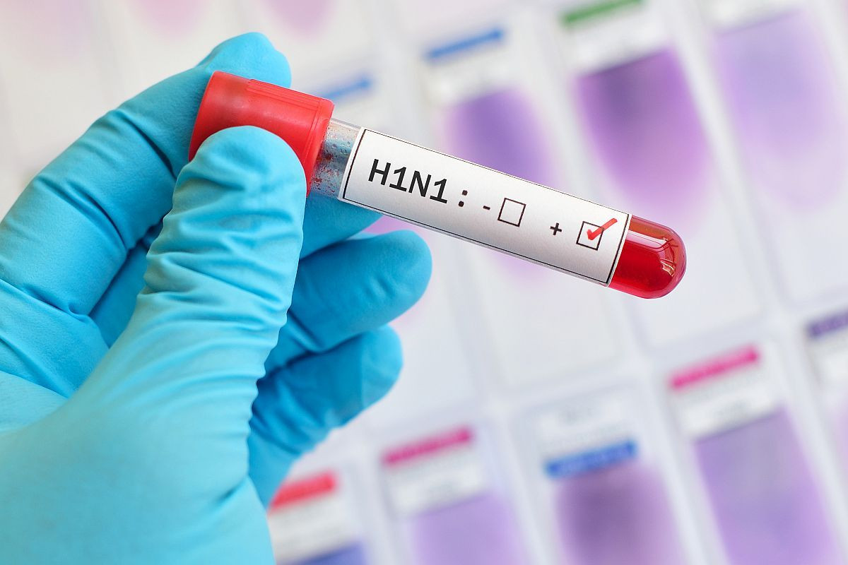 virus H1N1