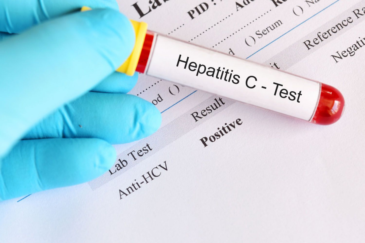 Hepatitis C
