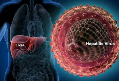 Mengenal Hepatitis, Mulai dari Cara Pencegahan Hingga Pengobatan