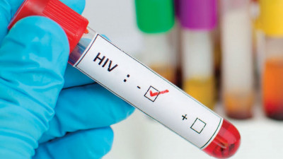 Setelah Berpuluh Tahun, Vaksin HIV Terbaru Akhirnya Menjanjikan