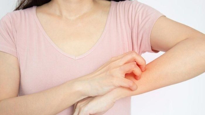 jamur kucing pada manusia