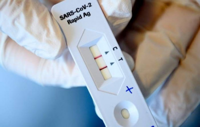 Hasil Antigen Positif Kini Bisa Langsung Dapatkan Layanan Obat dari Telemedicine