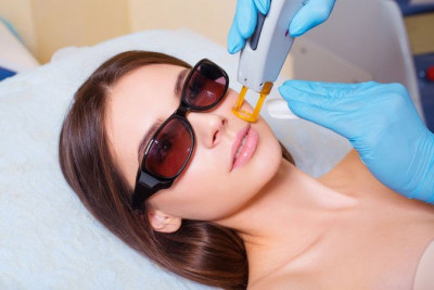 Mengenal Perawatan Kulit dengan Laser Erbium