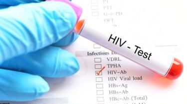 Kondom Bukan Satu-Satunya Cara Aman dari HIv