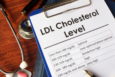 5 Tips Turunkan Kolesterol Tinggi dalam Darah