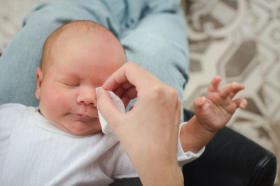 Bisakah Konjungtivitis Terjadi pada Bayi?
