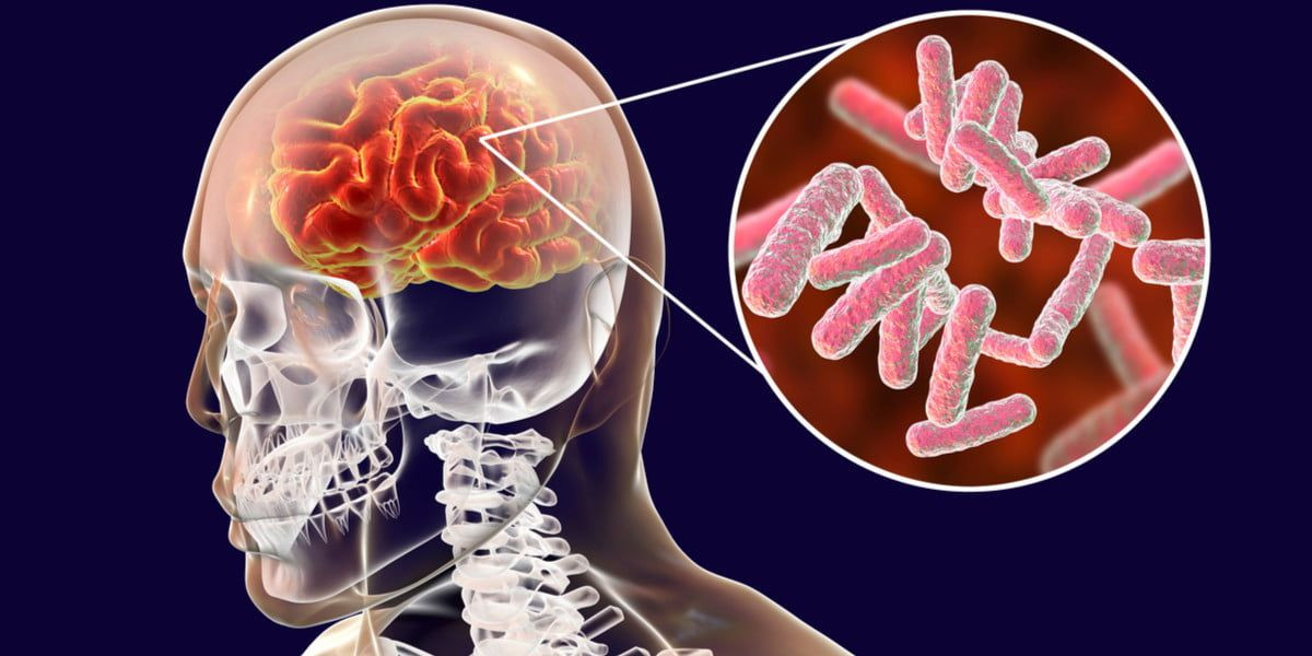 penyakit meningitis