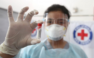 Berbagai Hasil Pengujian Tes Covid 19 dengan Menggunakan Air Liur