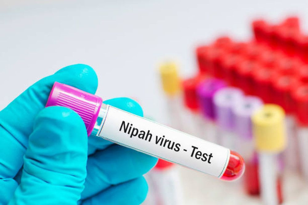 virus nipah