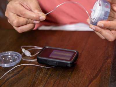 Inovasi Teknologi Diabetes Terbaru Dapat Menjadi Perangkat Pengiriman Insulin Bagi Penderita Diabetes