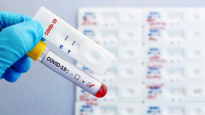 Rapid Test Tidak Berbahaya, Justru Melindungi Orang Lain
