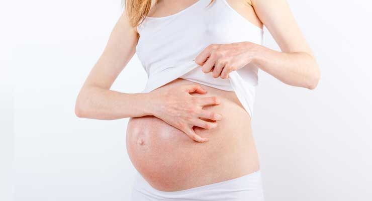 7 Penyebab Muka Bruntusan Saat Hamil Yang Harus Diwaspadai 7 Penyebab Muka Bruntusan Saat Hamil Yang Harus Diwaspadai