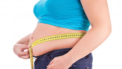 Ini Risiko Kesehatan pada Wanita yang Mengalami Obesitas