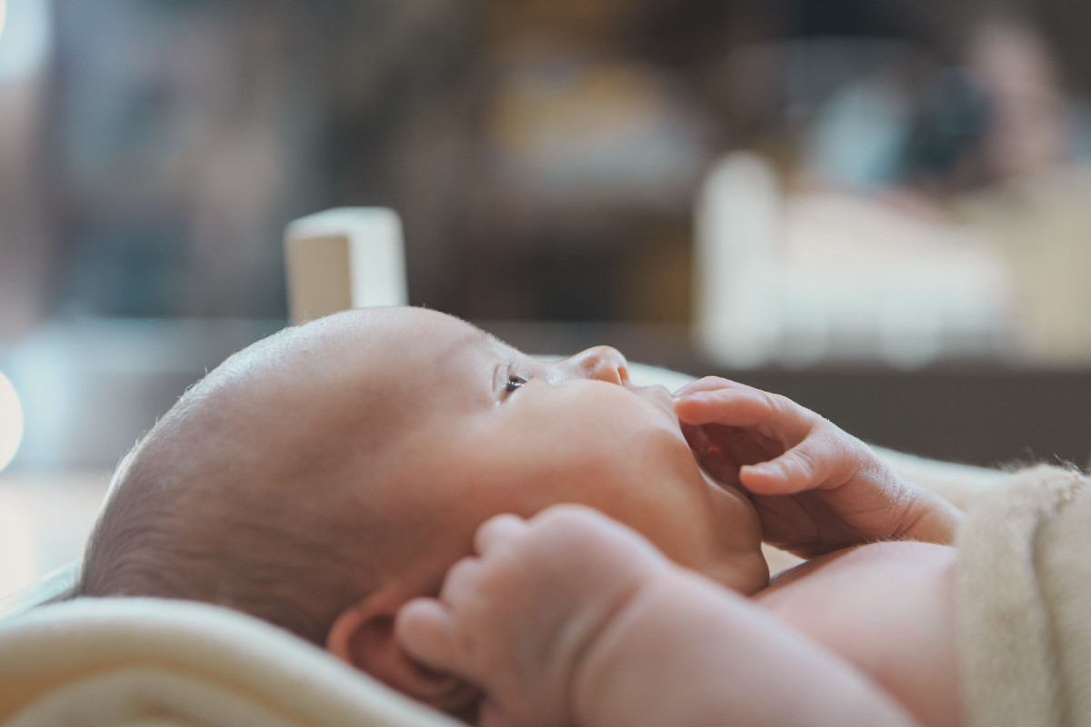 Bayi alami perubahan warna di bibir 