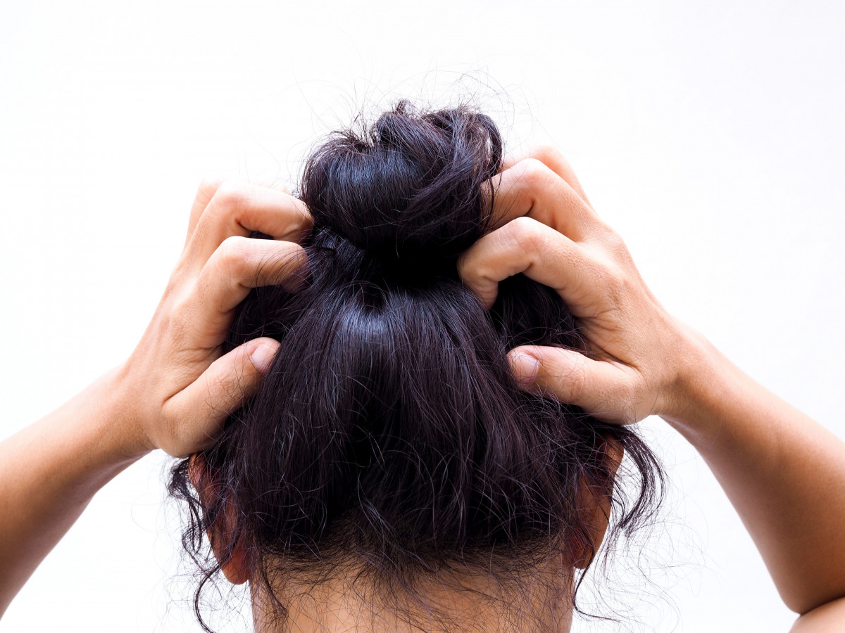 Seorang wanita sedang menggaruk rambut.