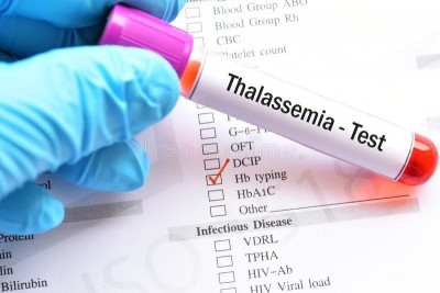 Meski Belum Bisa Disembuhkan, Talasemia Bisa Dideteksi Sejak Dini
