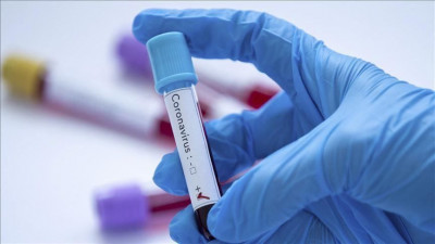Daftar Obat yang Diberikan Untuk Perawatan Pasien Covid-19