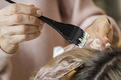Bolehkah Mewarnai Rambut saat Scalp Psoriasis Sedang Kambuh